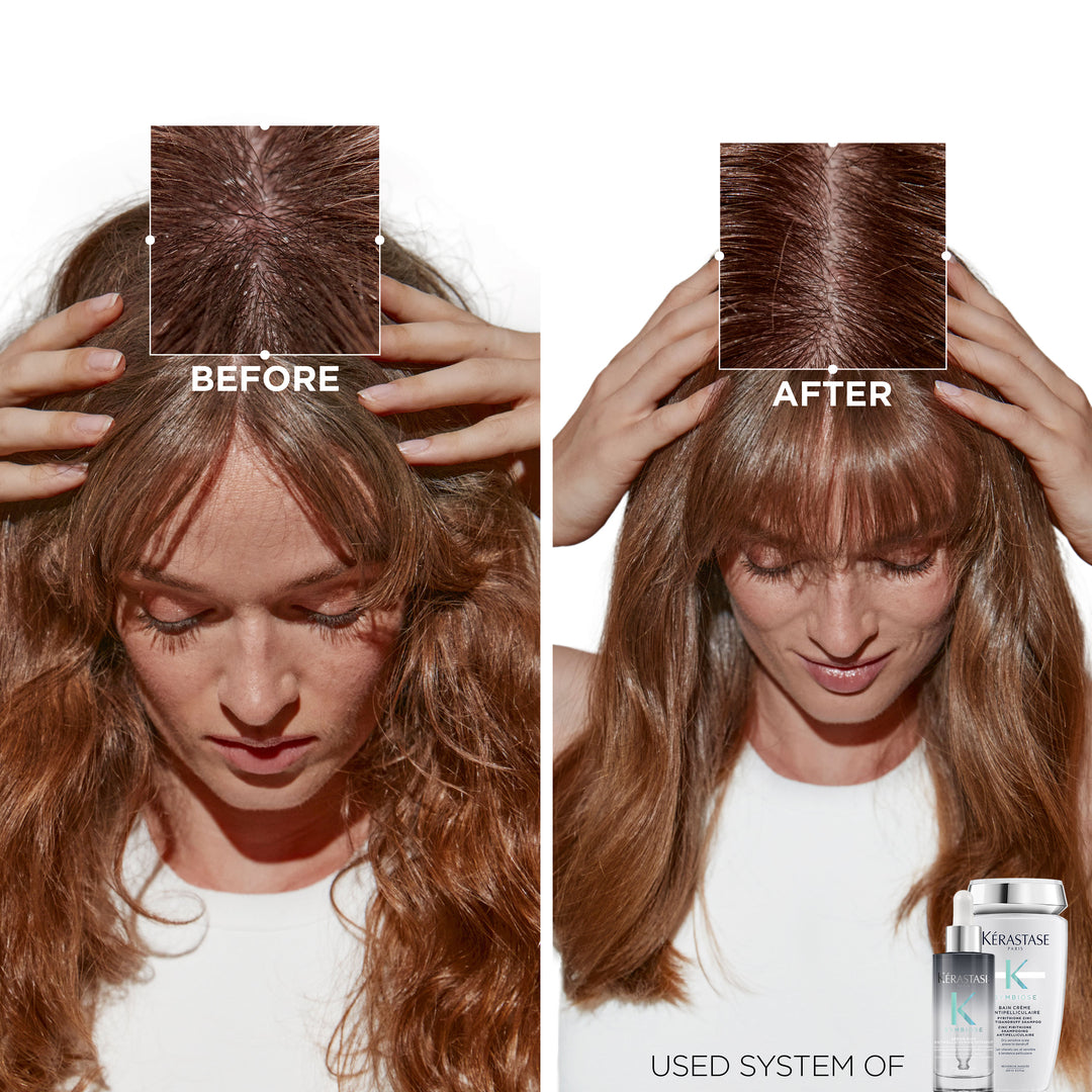 Kerastase Bain Creme Antipelliculaire Antidandruff Shampoo before after