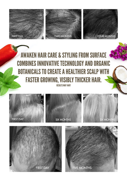 Surface Hair | Awaken Therapeutic Treatment
