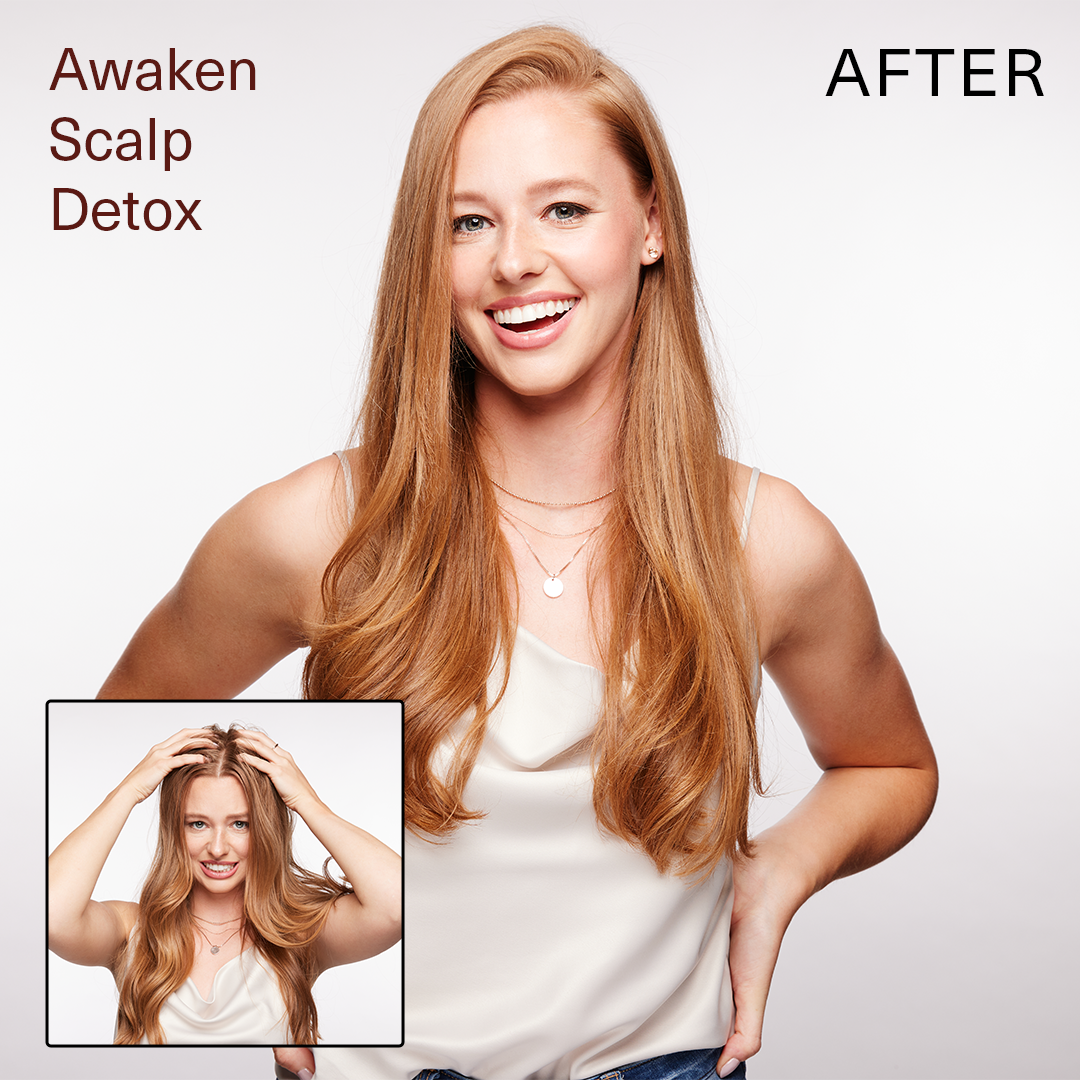 Surface Hair | Awaken Scalp Detox