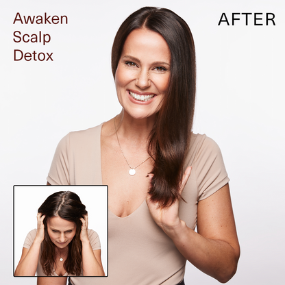 Surface Hair | Awaken Scalp Detox